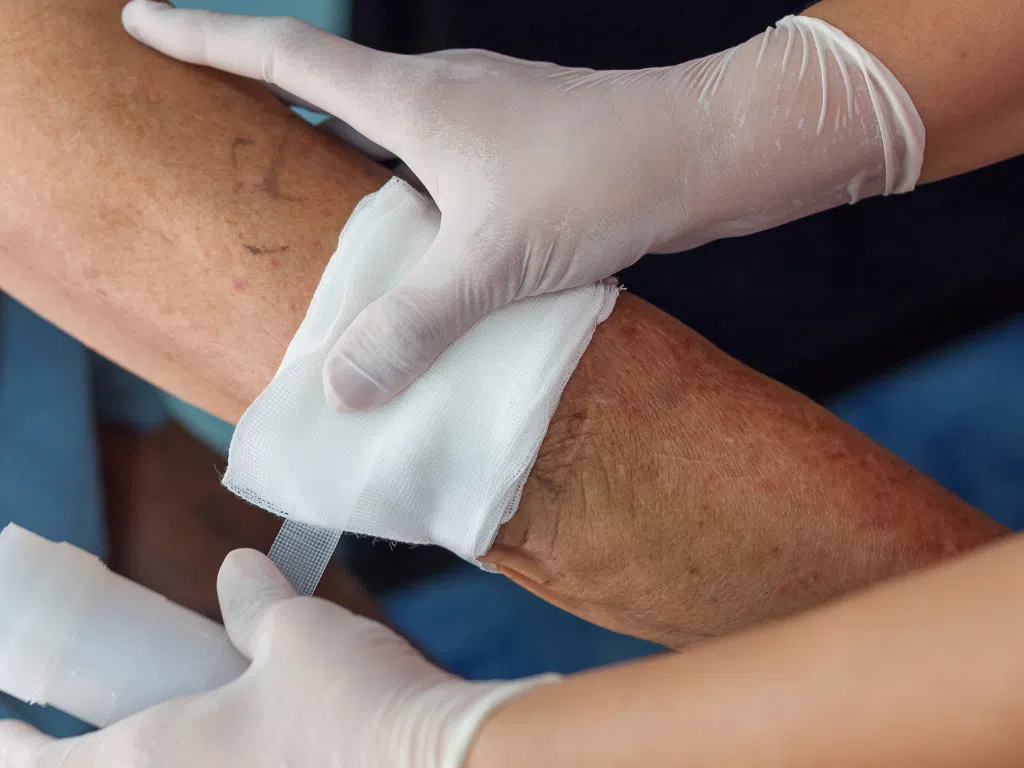 wundversorgung-pflegedienst-haeusliche-wundpflege wundversorgung-pflegedienst-haeusliche-wundpflege